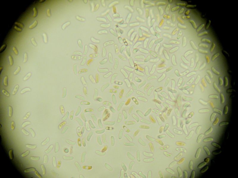 Crosta giallina da determinare (Hyphoderma radula)